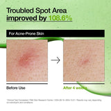 Buy Original ANUA Azelaic Acid 10 Hyaluron Redness Soothing Serum - Online at Best Price in Pakistan Buy Original ANUA Azelaic Acid 10 Hyaluron Redness Soothing Serum - Online at Best Price in Pakistan