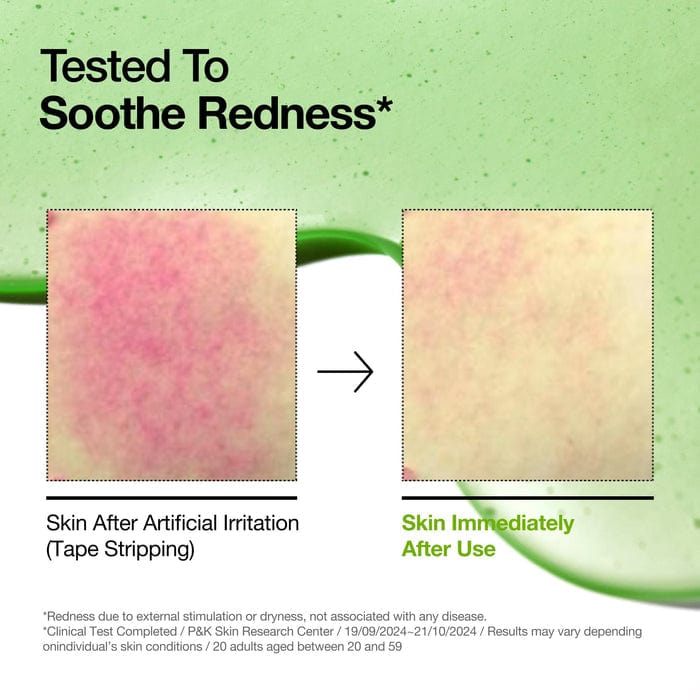 Buy Original ANUA Azelaic Acid 10 Hyaluron Redness Soothing Serum - Online at Best Price in Pakistan Buy Original ANUA Azelaic Acid 10 Hyaluron Redness Soothing Serum - Online at Best Price in Pakistan