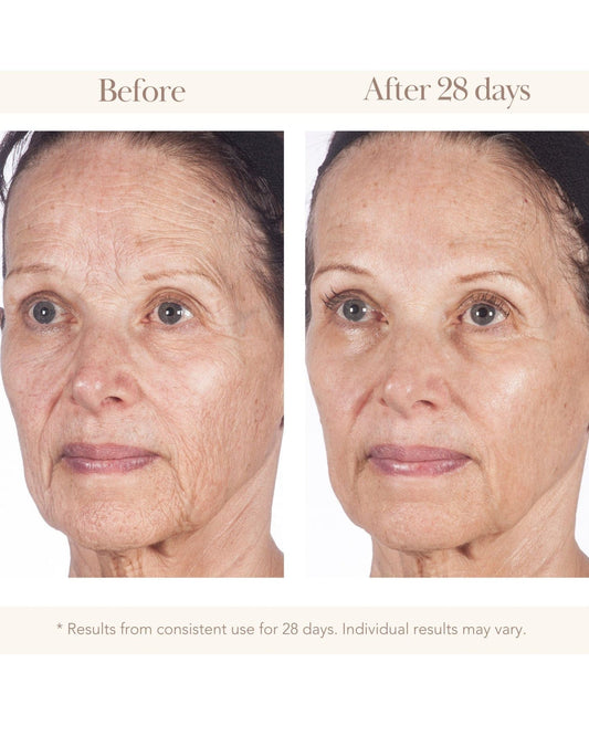 Buy Original Elizabeth Grant Supreme Triple Effect Essence of Torricelumn 145ml - Online at Best Price in Pakistan