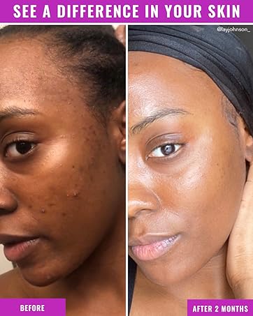 Buy Original Good Molecules Super Peptide Serum 30ml - Online at Best Price in Pakistan Buy Original Good Molecules Super Peptide Serum 30ml - Online at Best Price in Pakistan