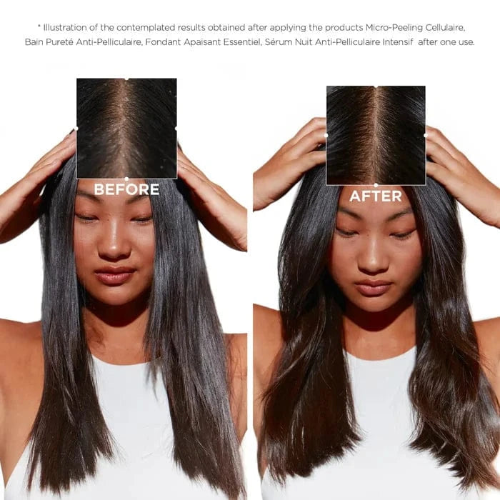 Buy Original Kerastase Symbiose Anti-Dandruff Regime for Sensitive Scalp Shampoo 250ml - Online at Best Price in Pakistan Buy Original Kerastase Symbiose Anti-Dandruff Regime for Sensitive Scalp Shampoo 250ml - Online at Best Price in Pakistan