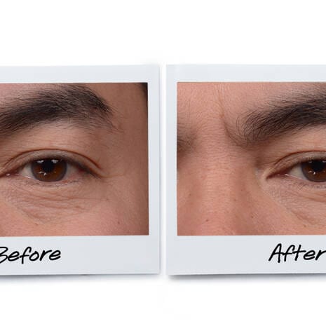 Buy Original Kiehl's Age Defender Eye Repair Cream For Men 3ml - Online at Best Price in Pakistan