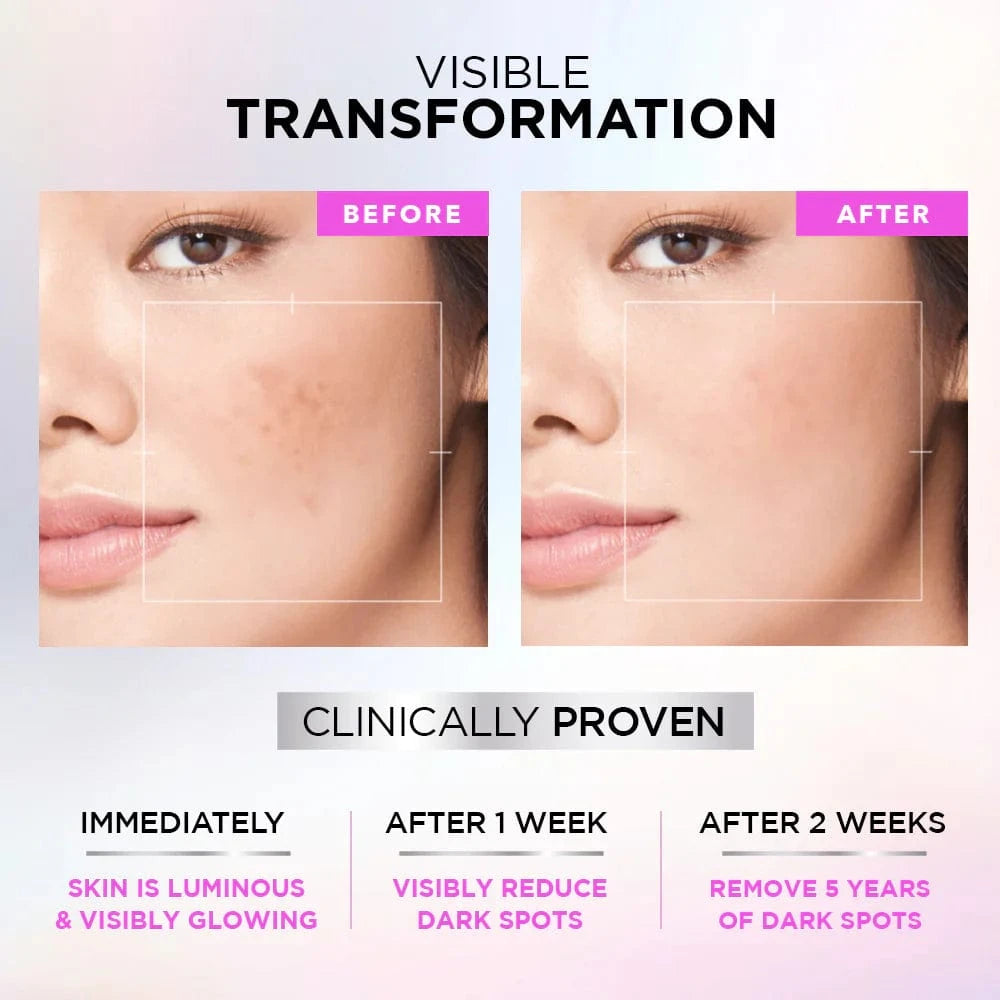 Buy Original LOreal Paris Glycolic Bright 8% Serum – 7.5ml - Online at Best Price in Pakistan Buy Original LOreal Paris Glycolic Bright 8% Serum – 7.5ml - Online at Best Price in Pakistan