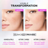 Buy Original LOreal Paris Glycolic Bright 8% Serum – 7.5ml - Online at Best Price in Pakistan Buy Original LOreal Paris Glycolic Bright 8% Serum – 7.5ml - Online at Best Price in Pakistan