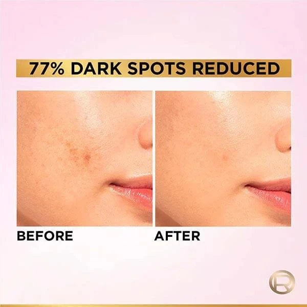 Buy Original LOreal Paris Glycolic Bright 8% Serum – 7.5ml - Online at Best Price in Pakistan Buy Original LOreal Paris Glycolic Bright 8% Serum – 7.5ml - Online at Best Price in Pakistan