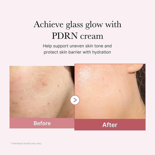 Buy Original Medicube Pdrn Pink Hyaluronic Moisturizing Cream 50ml - Online at Best Price in Pakistan