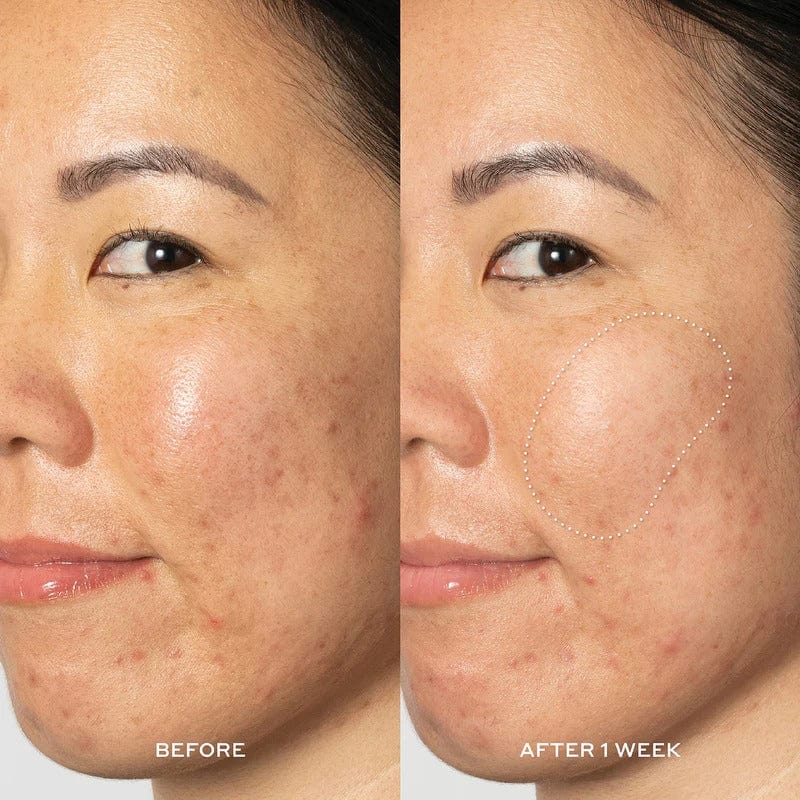 Buy Original OLEHENRIKSEN Glow2OH Dark Spot Toner 190ml - Online at Best Price in Pakistan Buy Original OLEHENRIKSEN Glow2OH Dark Spot Toner 190ml - Online at Best Price in Pakistan