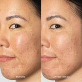 Buy Original OLEHENRIKSEN Glow2OH Dark Spot Toner 190ml - Online at Best Price in Pakistan Buy Original OLEHENRIKSEN Glow2OH Dark Spot Toner 190ml - Online at Best Price in Pakistan