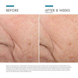Buy Original Skin Ceuticals Triple Lipid Restore 2:4:2 48ml - Online at Best Price in Pakistan Buy Original Skin Ceuticals Triple Lipid Restore 2:4:2 48ml - Online at Best Price in Pakistan