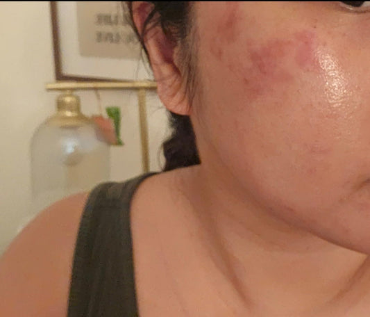 Buy Original VT Cosmetics Cica Reedle Shot 100 50ml - Online at Best Price in Pakistan