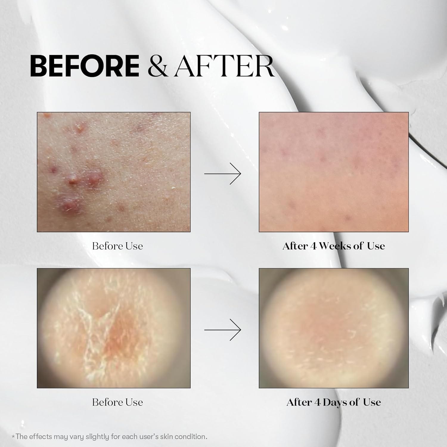 Buy Original VT Cosmetics Cica Reedle Shot 100 50ml - Online at Best Price in Pakistan Buy Original VT Cosmetics Cica Reedle Shot 100 50ml - Online at Best Price in Pakistan