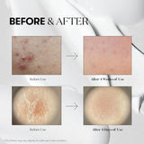 Buy Original VT Cosmetics Cica Reedle Shot 100 50ml - Online at Best Price in Pakistan Buy Original VT Cosmetics Cica Reedle Shot 100 50ml - Online at Best Price in Pakistan