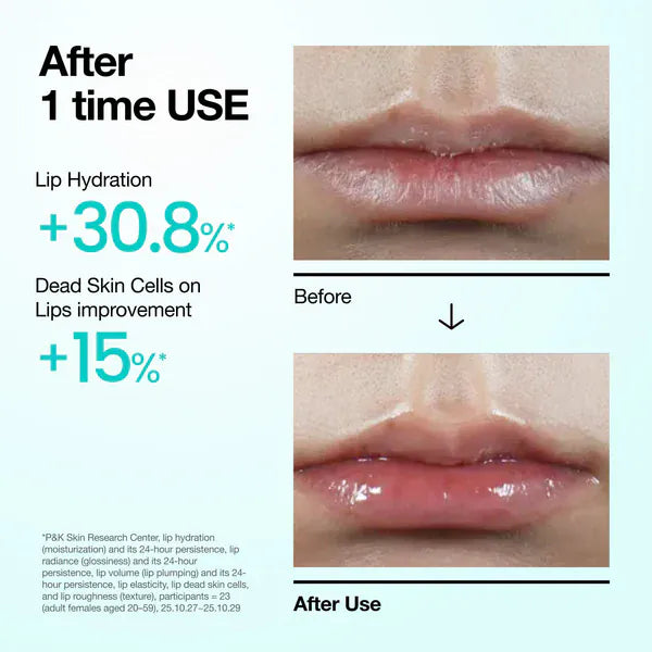 Buy Original Anua PDRN Lip Serum 10ml - Online at Best Price in Pakistan