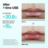 Buy Original Anua PDRN Lip Serum 10ml - Online at Best Price in Pakistan