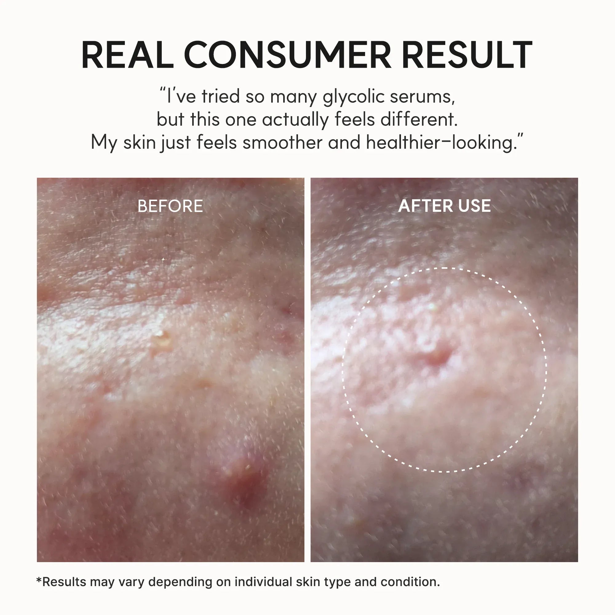 Buy Original Arencia Eraser Shot Glycolic Acid Booster 30ml - Online at Best Price in Pakistan
