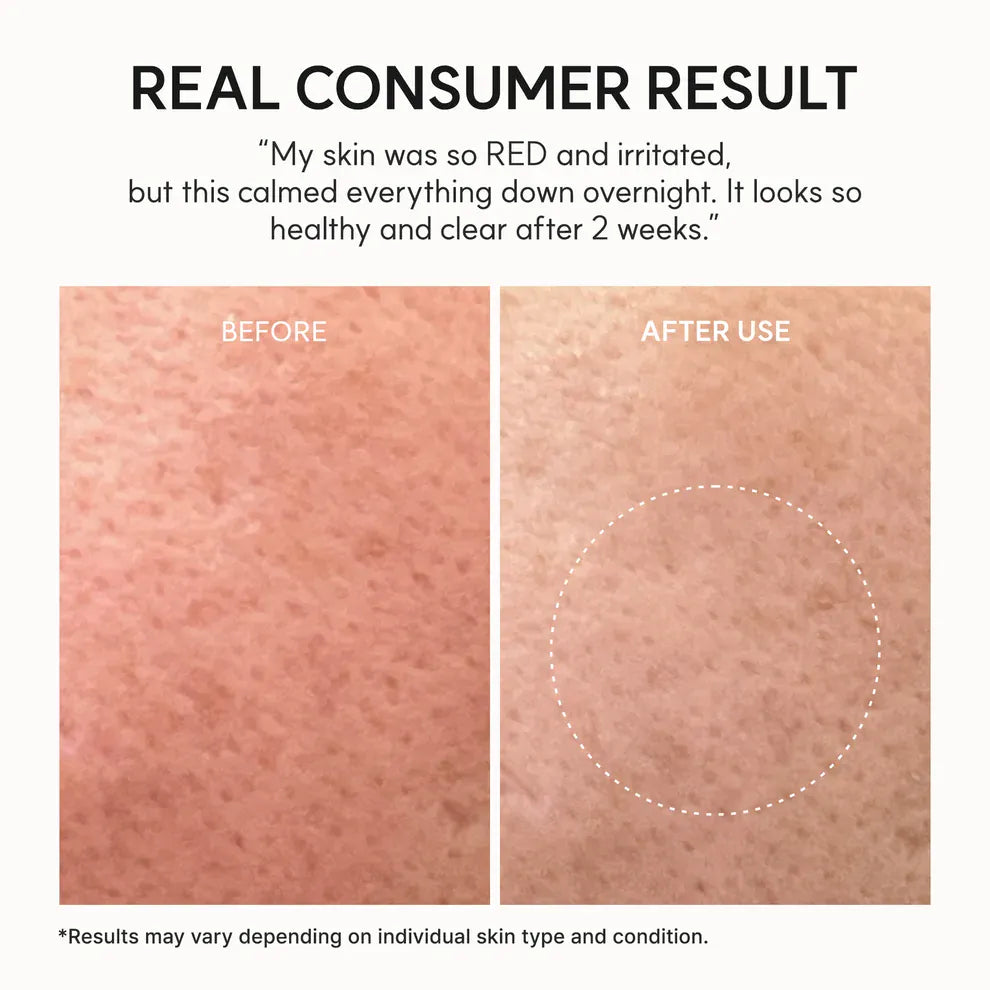Buy Original Arencia Eraser Soothing Cream 50ml - Online at Best Price in Pakistan