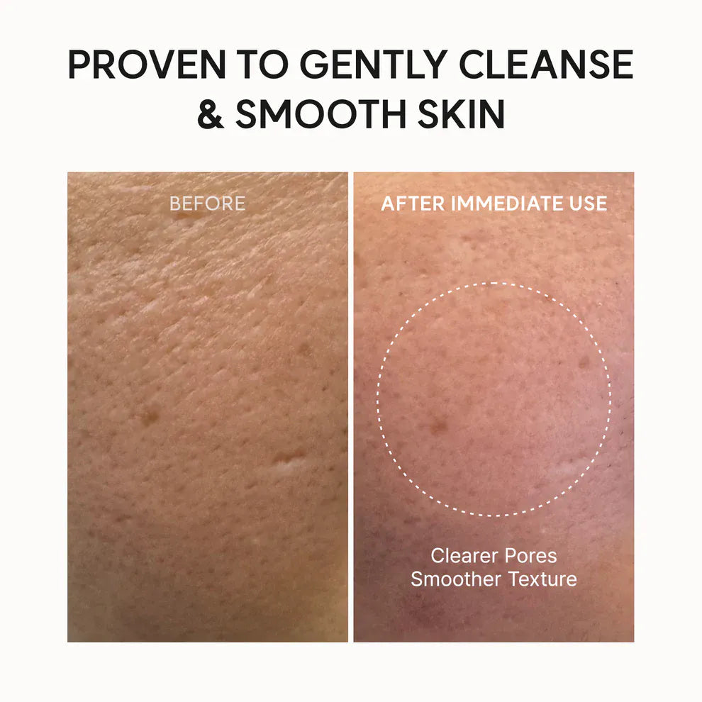 Buy Original Arencia Fresh Rosehip Mochi Cleanser 120g - Online at Best Price in Pakistan