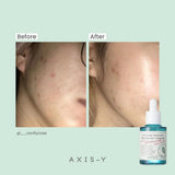 Buy Original Axis Y Artichoke Intensive Skin Barrier Ampoule 30ml - Online at Best Price in Pakistan