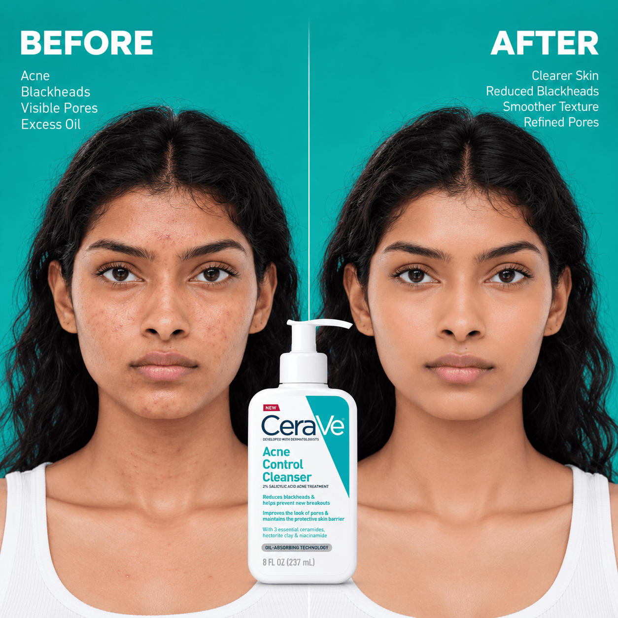 Buy Original CeraVe Acne Control Cleanser 473ml - Online at Best Price in Pakistan