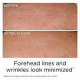 Buy Original Elizabeth Arden PREVAGE Anti-Aging Daily Serum 2.0 - Online at Best Price in Pakistan