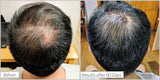 Buy Original Densifique Cure Densifique Homme Scalp Treatment - Online at Best Price in Pakistan