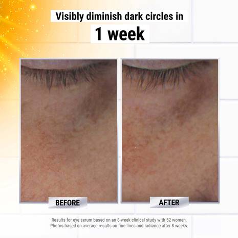 Buy Original Kiehl's Powerful-Strength Dark Circle Reducing Vitamin C Eye Serum 3 ml - Online at Best Price in Pakistan