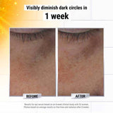 Buy Original Kiehl's Powerful-Strength Dark Circle Reducing Vitamin C Eye Serum 3 ml - Online at Best Price in Pakistan