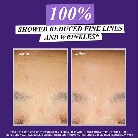Buy Original Micro-Dose Anti-Aging Retinol Serum with Ceramides and Peptide - Online at Best Price in Pakistan