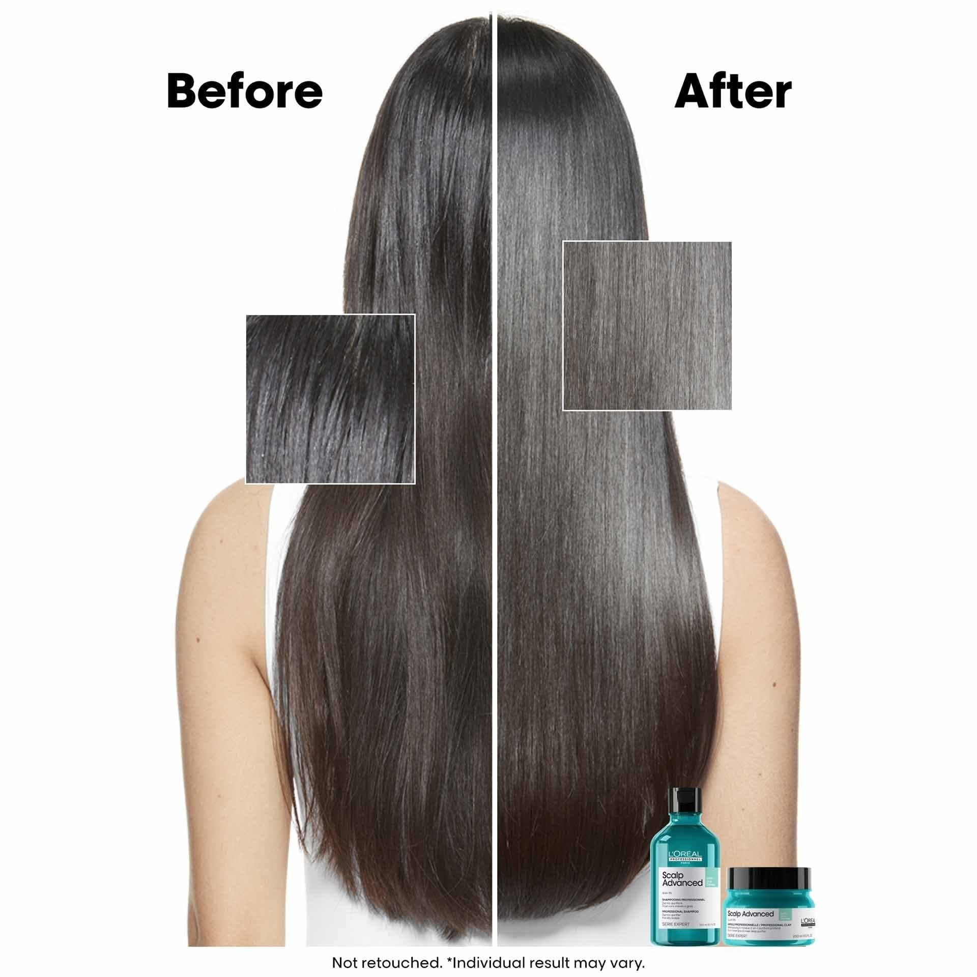Buy Original LOreal Professionnel Serie Expert Scalp Advanced Anti-Oiliness Shampoo 500ml - Online at Best Price in Pakistan