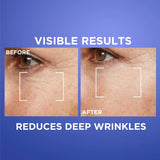 Buy Original LOreal Paris Revitalift Laser 0.2 Pure Retinol Wrinkle Night Serum 30ml - Online at Best Price in Pakistan