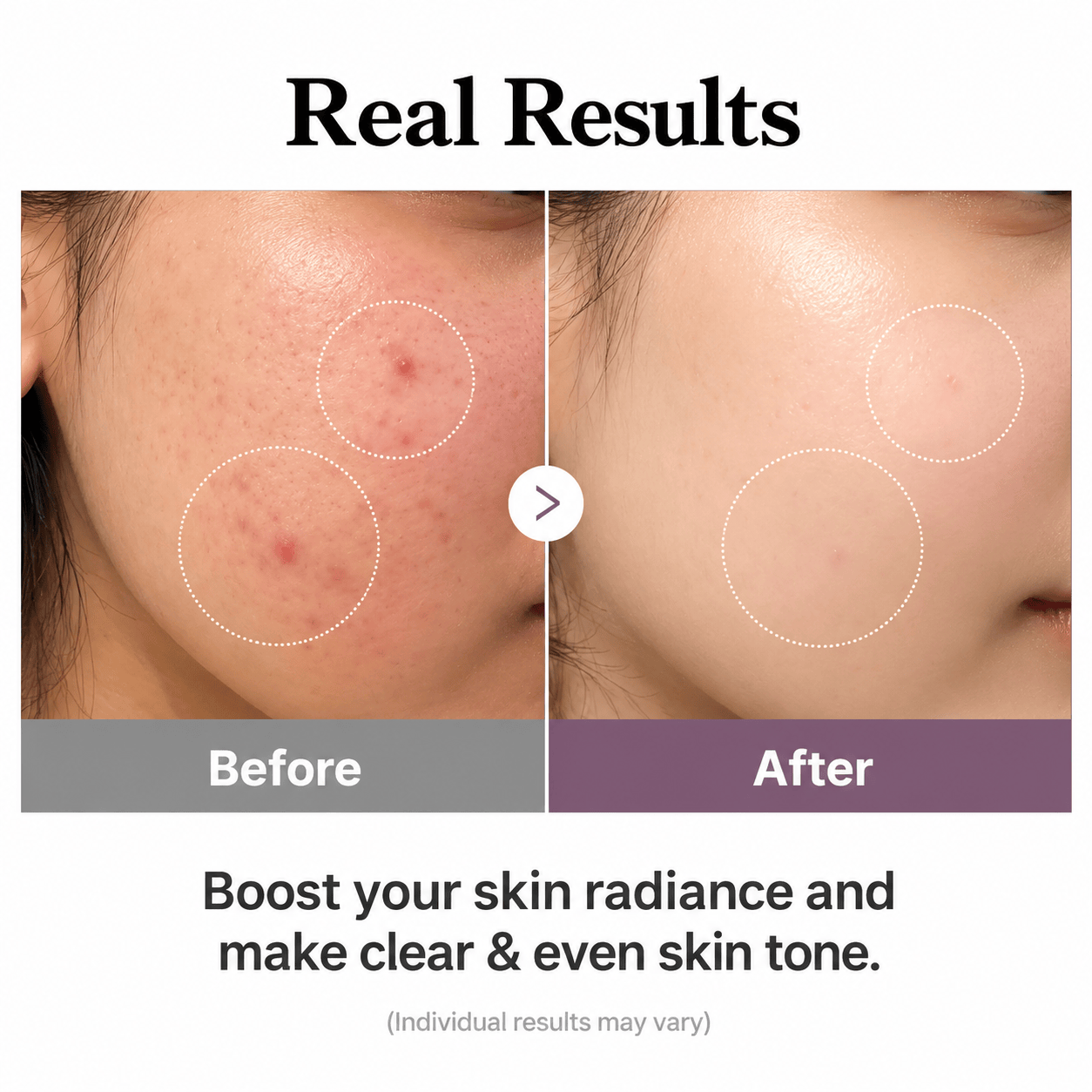 Buy Original Medicube Age-R Glutathione Glow Toner 140ml - Online at Best Price in Pakistan