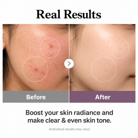 Buy Original Medicube Age-R Glutathione Glow Toner 140ml - Online at Best Price in Pakistan