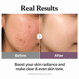 Buy Original Medicube Age-R Glutathione Glow Toner 140ml - Online at Best Price in Pakistan