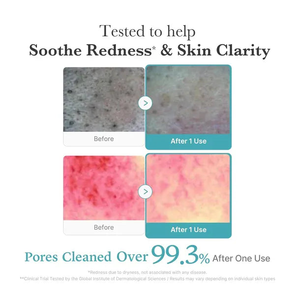 Buy Original Medicube Azelaic Acid Niacinamide Deep Clean Foam Cleanser 120g - Online at Best Price in Pakistan