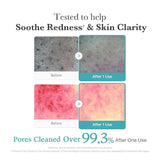 Buy Original Medicube Azelaic Acid Niacinamide Deep Clean Foam Cleanser 120g - Online at Best Price in Pakistan