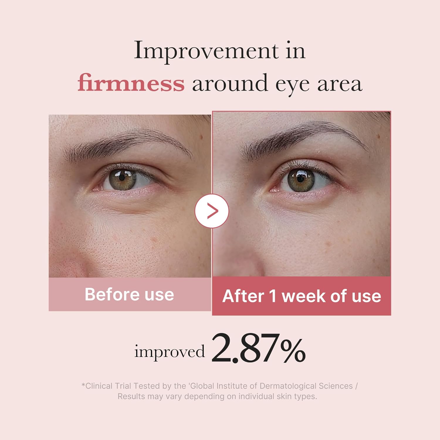 Buy Original Medicube PDRN Pink Peptide Eye Cream 30ml - Online at Best Price in Pakistan