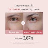 Buy Original Medicube PDRN Pink Peptide Eye Cream 30ml - Online at Best Price in Pakistan