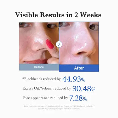 Buy Original Medicube Zero Pore Blackhead Deep Cleansing Oil 205ml - Online at Best Price in Pakistan