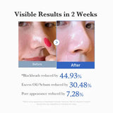 Buy Original Medicube Zero Pore Blackhead Deep Cleansing Oil 205ml - Online at Best Price in Pakistan
