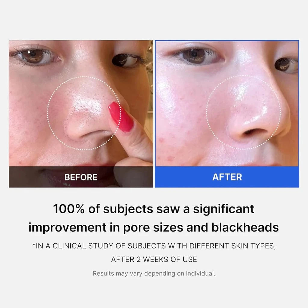 Buy Original Medicube Zero Pore Pad Mild - Online at Best Price in Pakistan