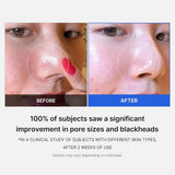 Buy Original Medicube Zero Pore Pad Mild - Online at Best Price in Pakistan