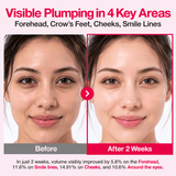 Buy Original Numbuzin No.2 Rose PDRN Collagen 2X Plumping Serum 30ml - Online at Best Price in Pakistan
