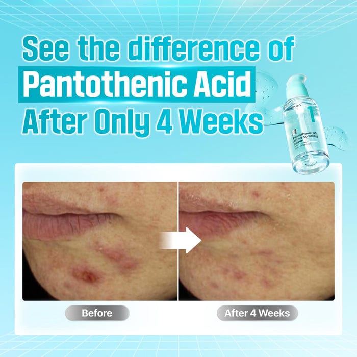 Buy Original numbuzinNo.1 Pantothenic B5 Active Soothing Face Serum - Online at Best Price in Pakistan