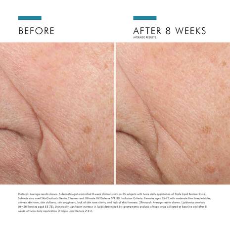 Buy Original Skin Ceuticals Triple Lipid Restore 2:4:2 48ml - Online at Best Price in Pakistan
