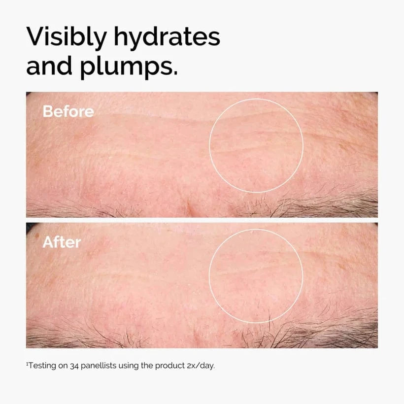 Buy Original The Ordinary Hyaluronic Acid 2% + B5 30ml - Online at Best Price in Pakistan